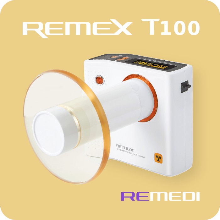 REMEX T100 - Портативний дентальний рентген апарат | REMEDI