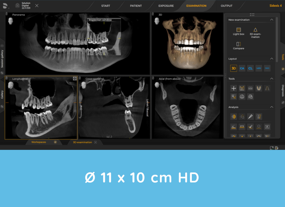 Orthophos S 3D X-rays example