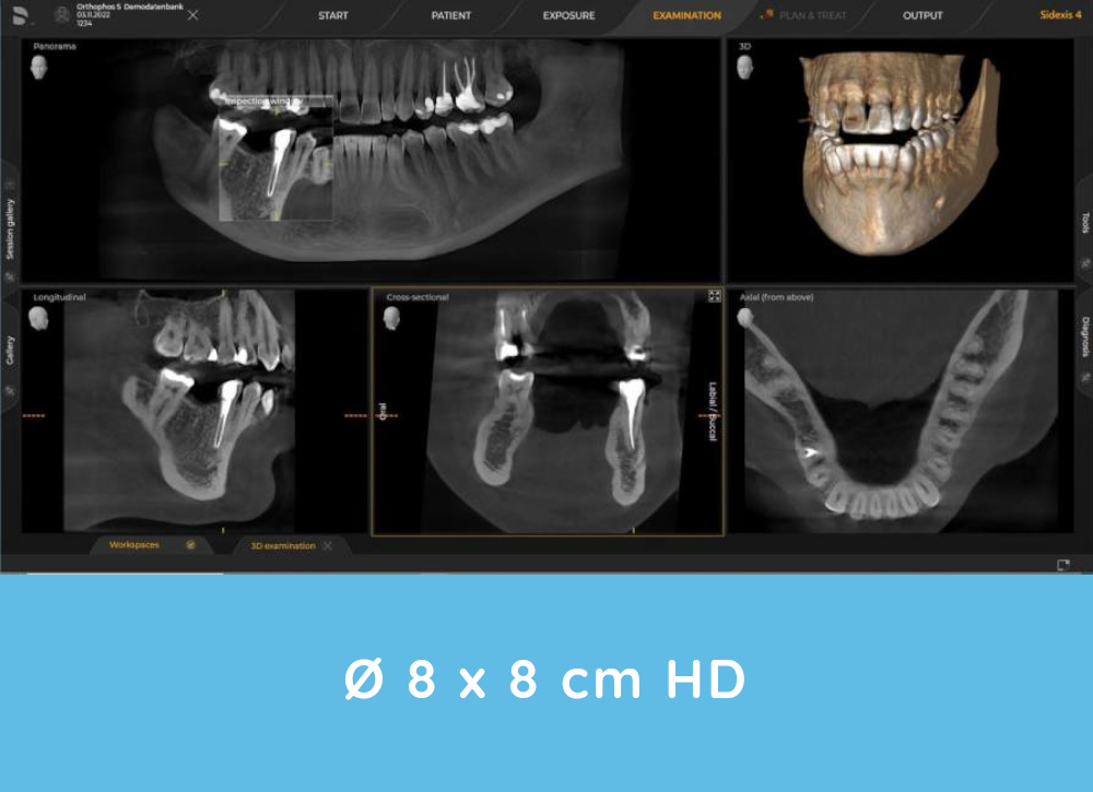 Orthophos S 3D X-rays example