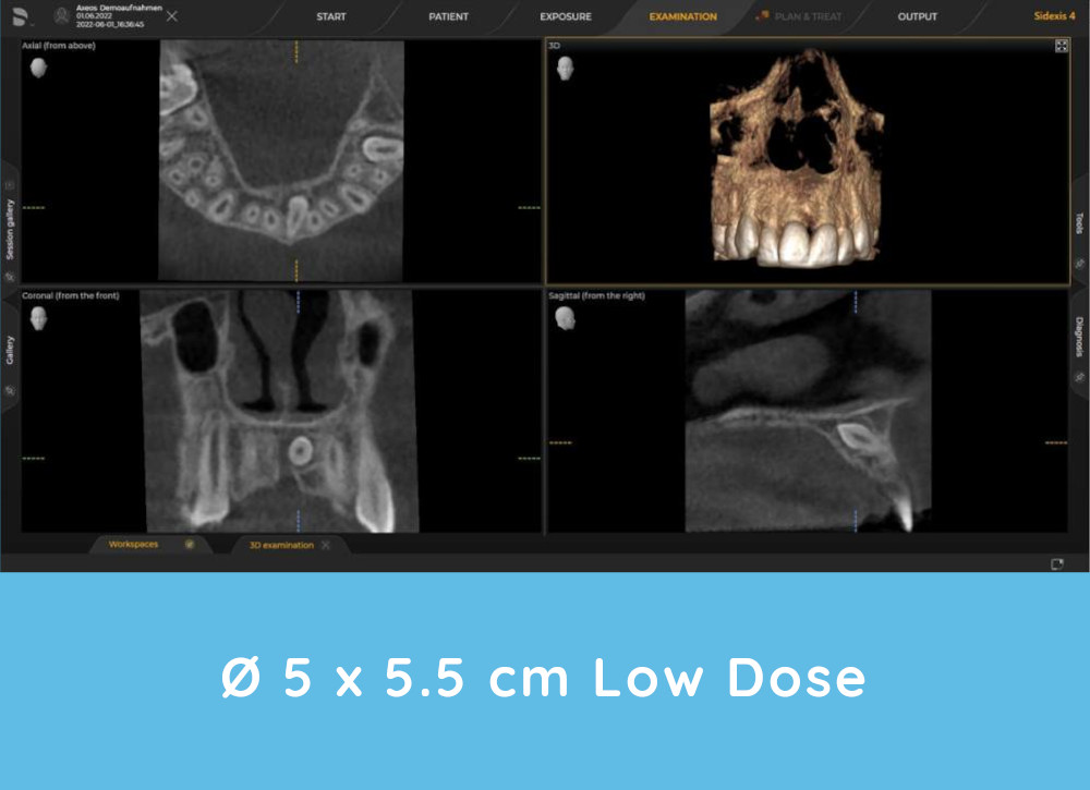 Axeos 3D X-rays example