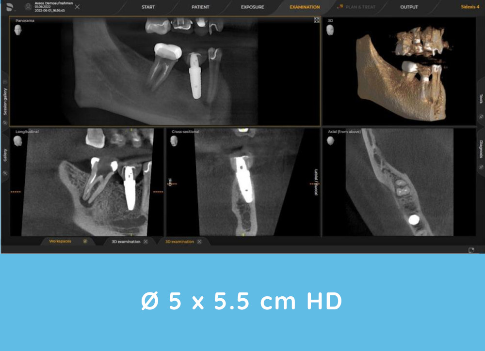 Axeos 3D X-rays example