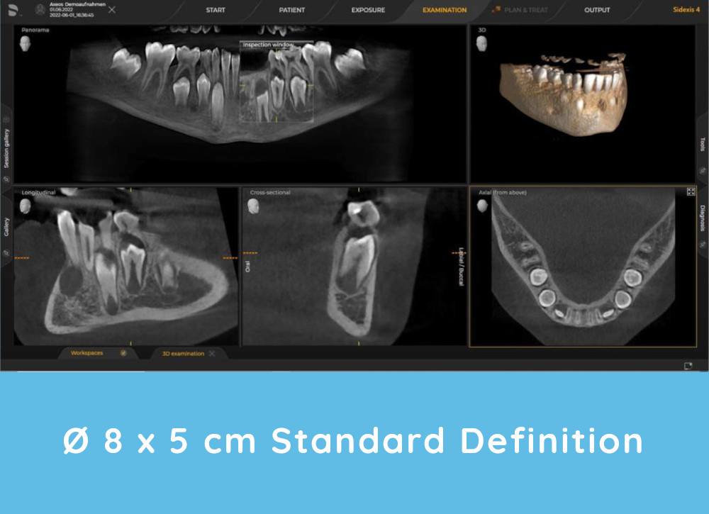 Axeos 3D X-rays example