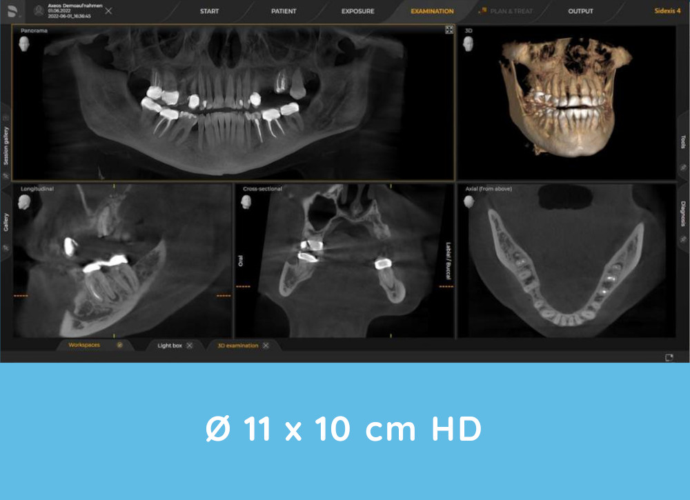 Axeos 3D X-rays example