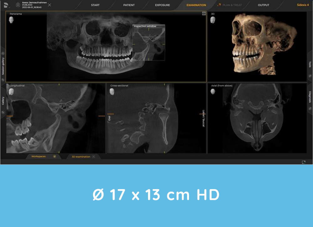 Axeos 3D X-rays example