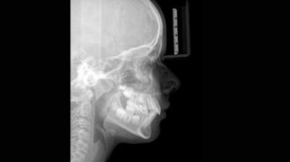 Axeos Cephalometric Images