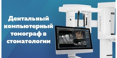 Дентальний комп'ютерний томограф в стоматології